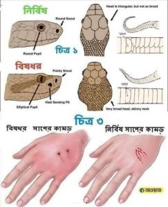 সাপে কাটলে